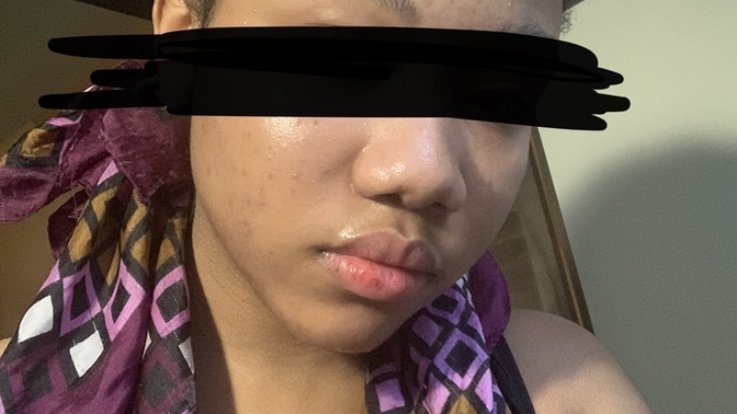 When is it normal for girls to usually lose their baby face/baby fat?