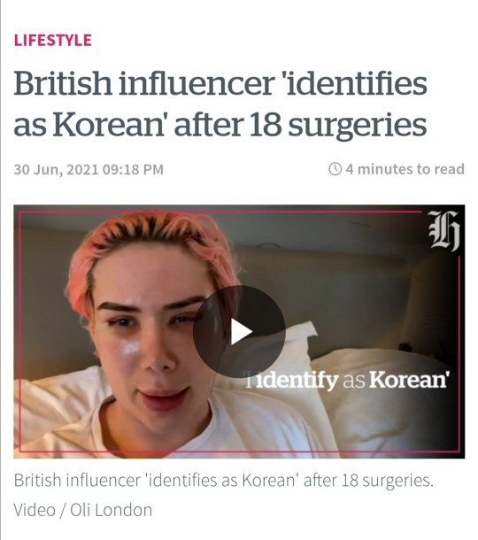 What do you think about Oli London coming out as transracial?
