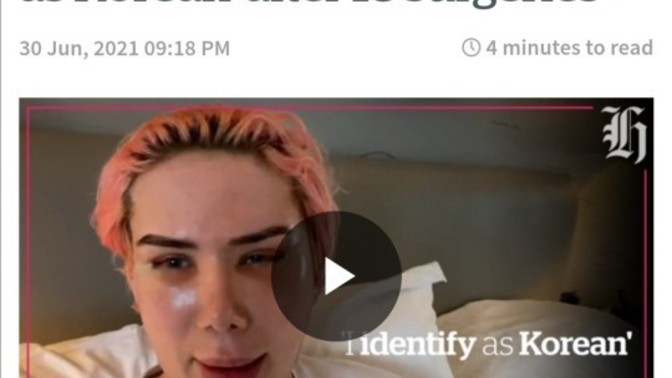 What do you think about Oli London coming out as transracial?