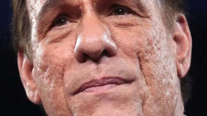 Girls, Would you date a guy with acne scars?