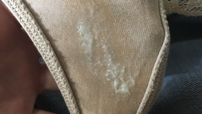 Girls, Is this discharge normal?