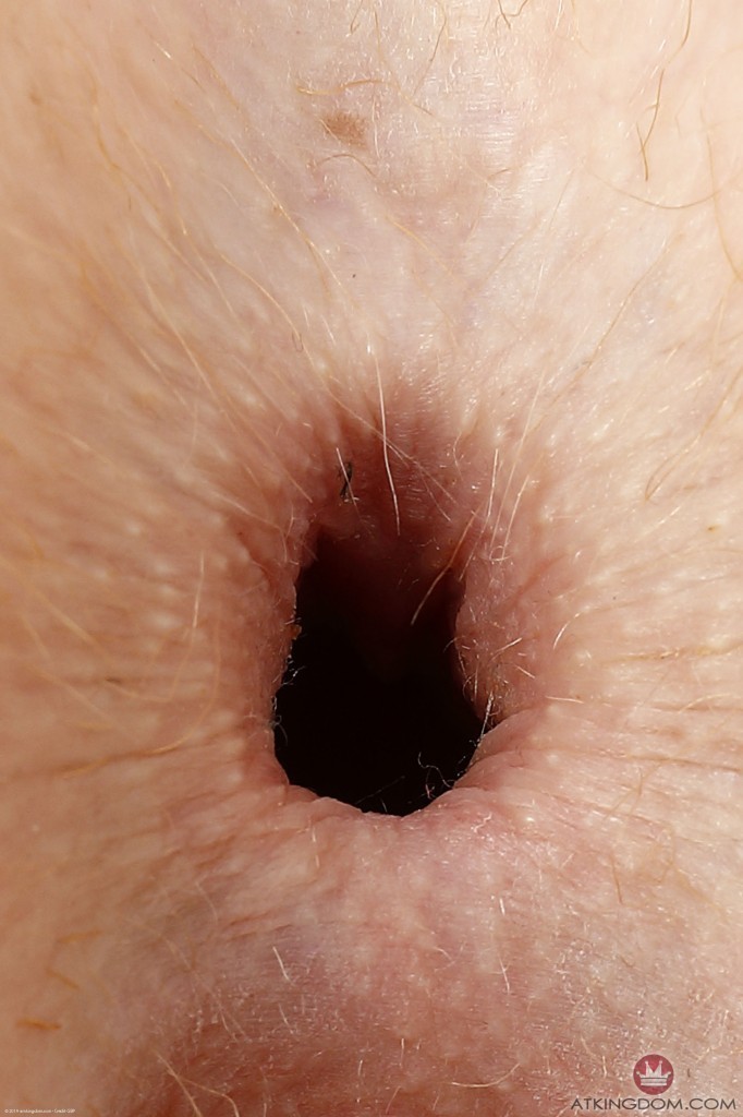 What does it mean if your bootyhole is itchy?