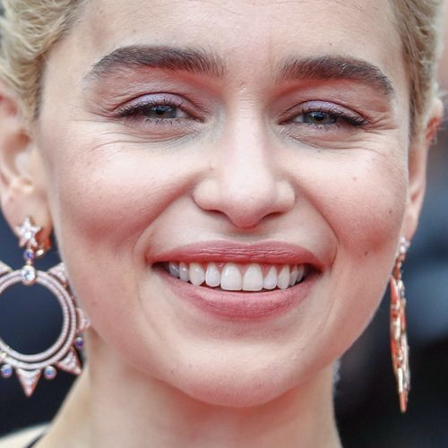 Are these lines considered wrinkles?