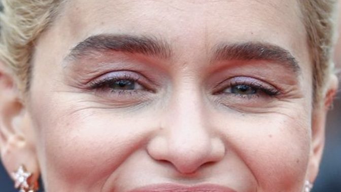 Are these lines considered wrinkles?