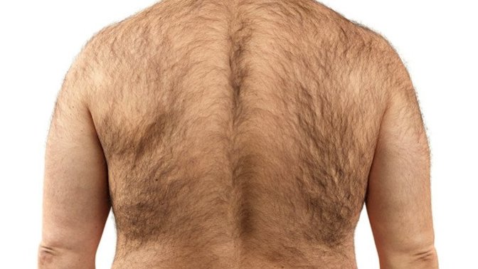 How many men (& some hairy ass women. You know who you are) need to shave their backs?