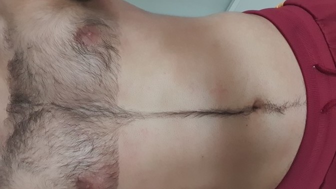 Do girls like hairy men?