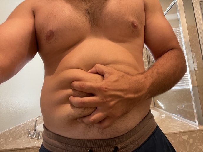 Just lost 30 pounds and a really big belly and I notice I’m stuck with this soft flubber anyone have this issue after losing weight?