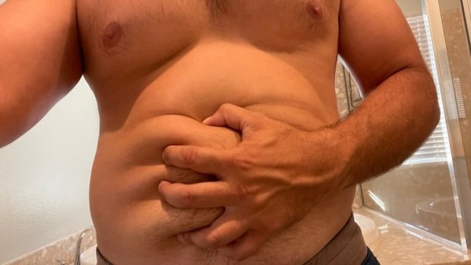 Just lost 30 pounds and a really big belly and I notice I’m stuck with this soft flubber anyone have this issue after losing weight?