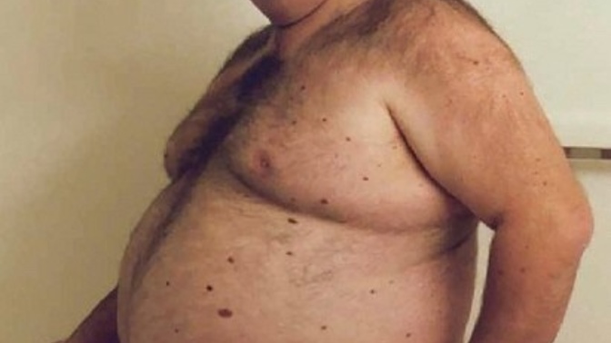 Why is it that the same women who condemn fatphobia are the same women who you never see dating or hooking up with fat men?