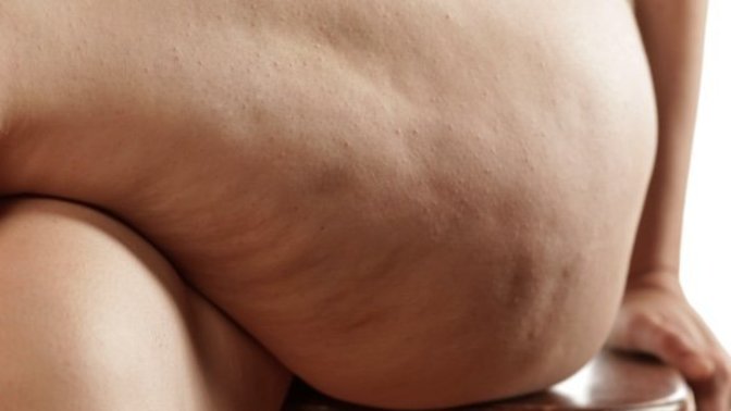 Do guys love or hate cellulite on women?