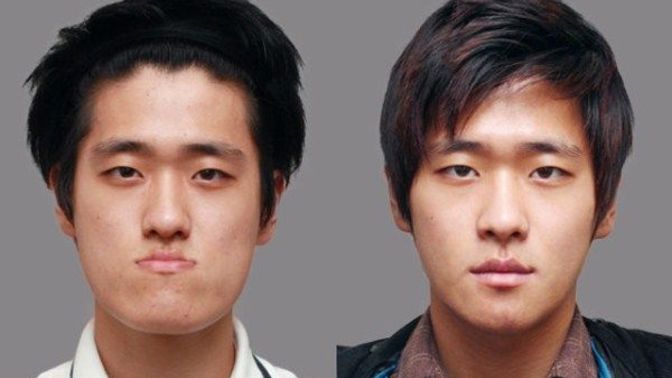 Would a person who has had cosmetic surgery be a turn off for you when it comes to dating?