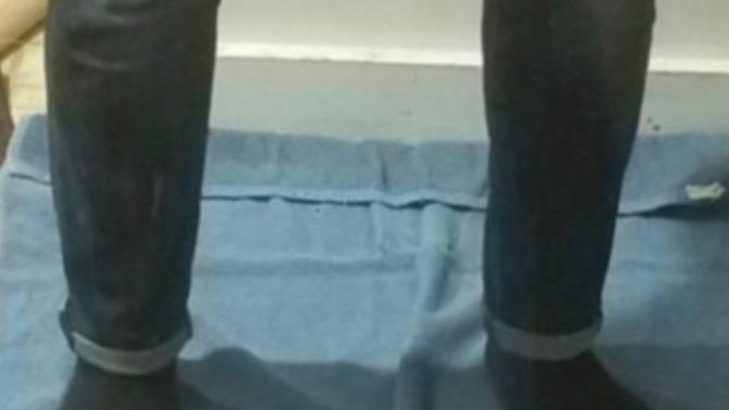 Which pair should I wear to my doctors appointment tomorrow?