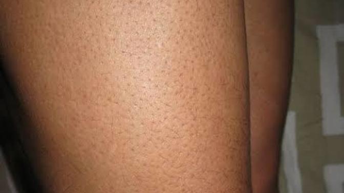 Do you like guys who shave legs because they're too hairy otherwise?