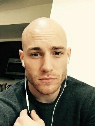 Would you date a bald woman/man?