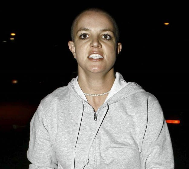 Would you date a bald woman/man?