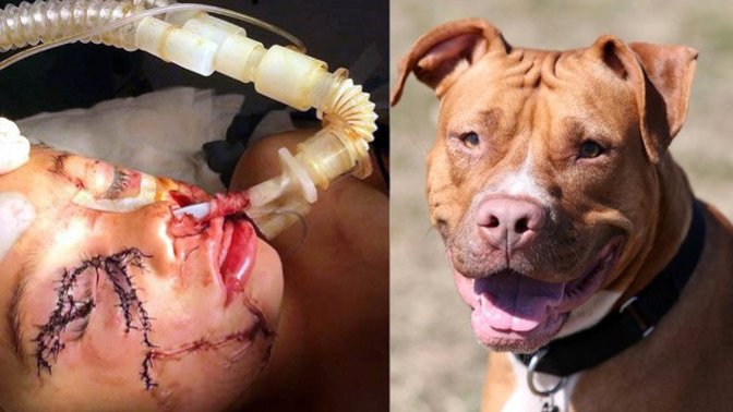 Would you own a pit bull?
