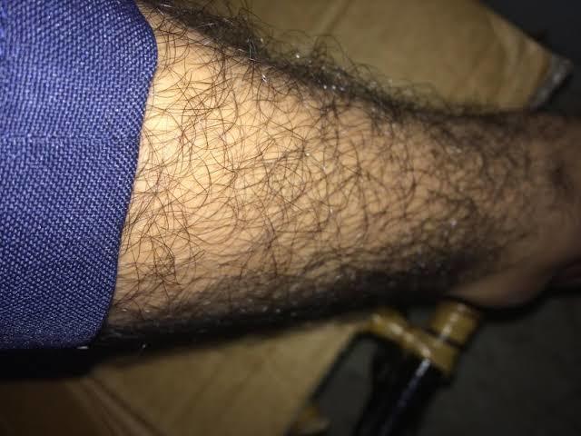 Preferred solution and choice for very hairy legs and arms on a guy?
