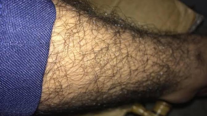 Preferred solution and choice for very hairy legs and arms on a guy?