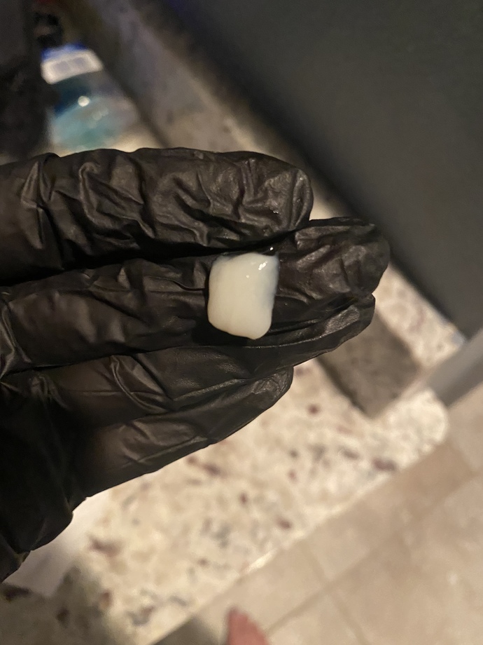 Weird mucus ball from nose?