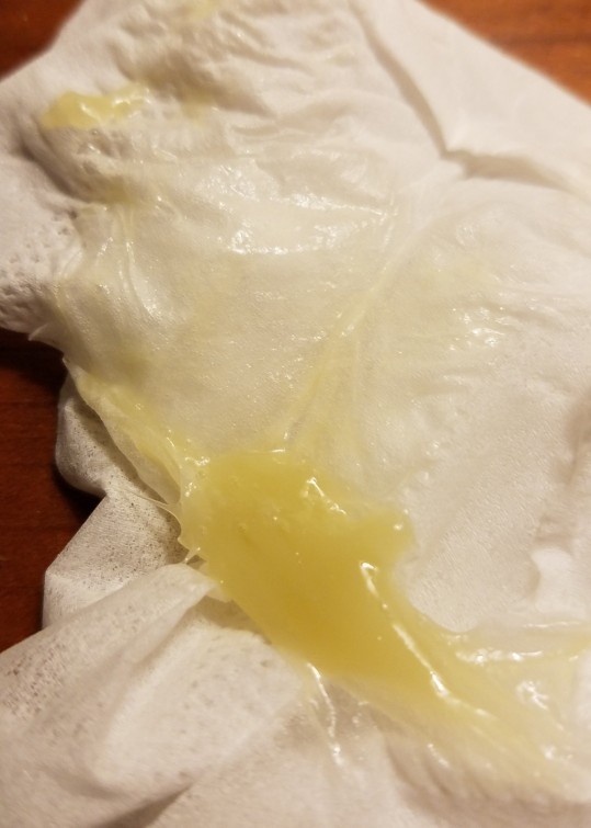 Weird mucus ball from nose?