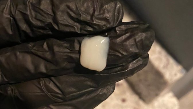 Weird mucus ball from nose?