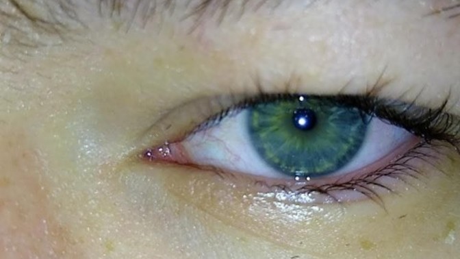 Is it normal for someone with blue or green eyes to alternate colors or have both at once?