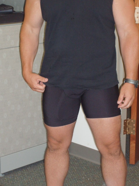 Legs