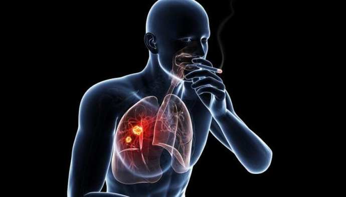 How would you react if a someone who was a chain smoker who didnt get lung cancer went around telling everyone the science about cigarettes is wrong?