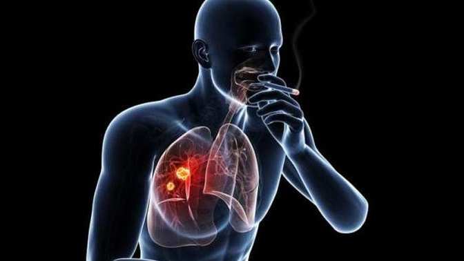 How would you react if a someone who was a chain smoker who didn't get lung cancer went around telling everyone the science about cigarettes is wrong?