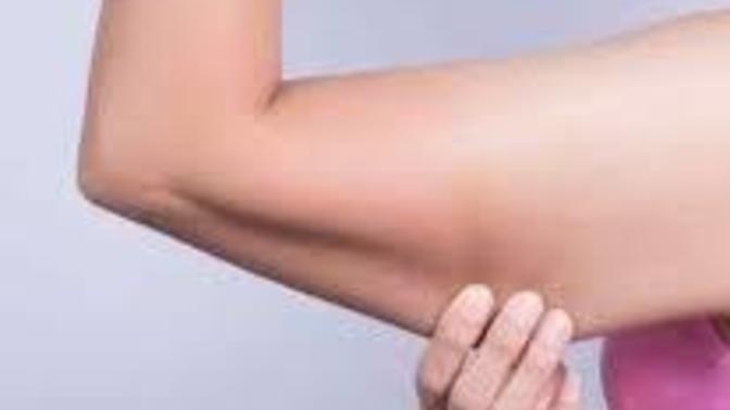 Men, would flabby arms and jiggly thighs be a deal breaker?