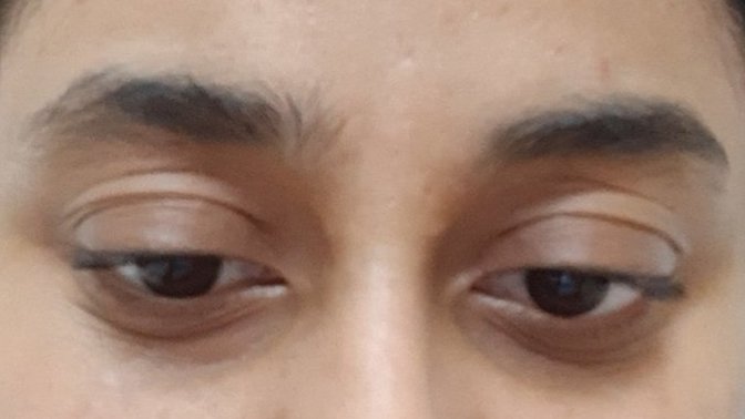 Would you shame your partner for having dark under eye circles?