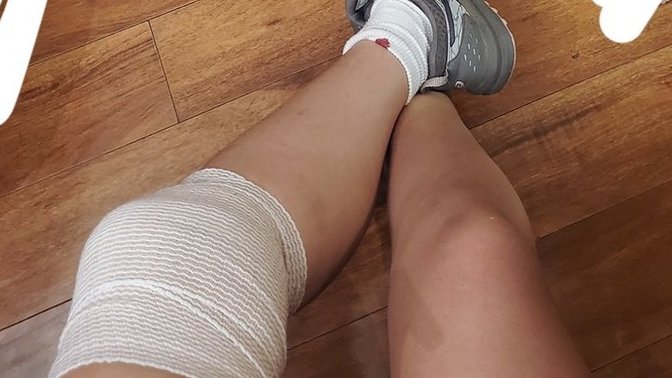Have you ever injured yourself while working out?