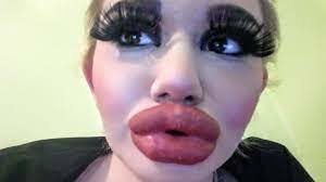 Are thin lips unattractive to men?