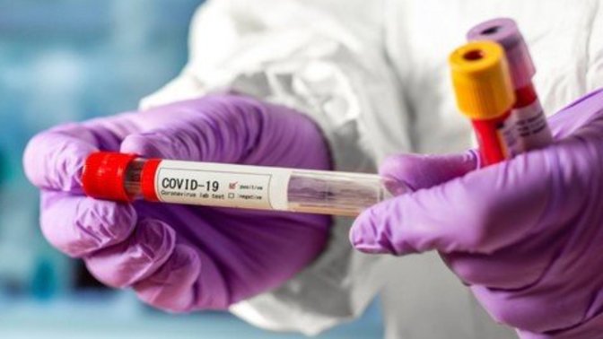 Do you think it's fair to say that evidence is mounting that COVID was created in a lab?