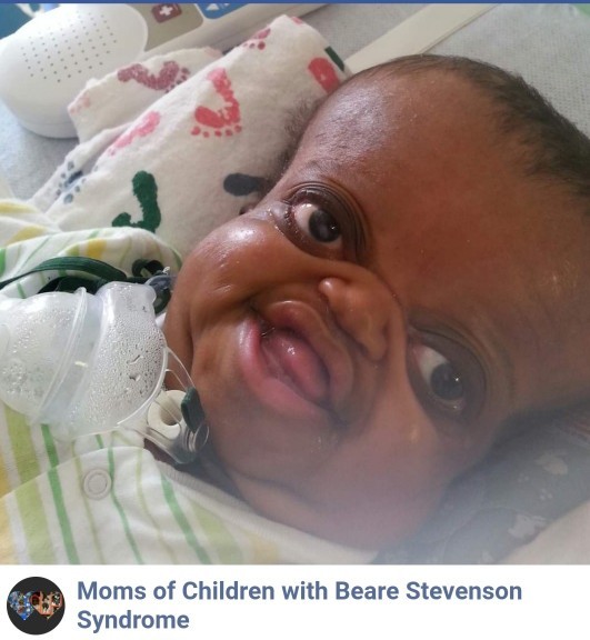 If your child came out like looking like this along with many other medical problems would you keep it?