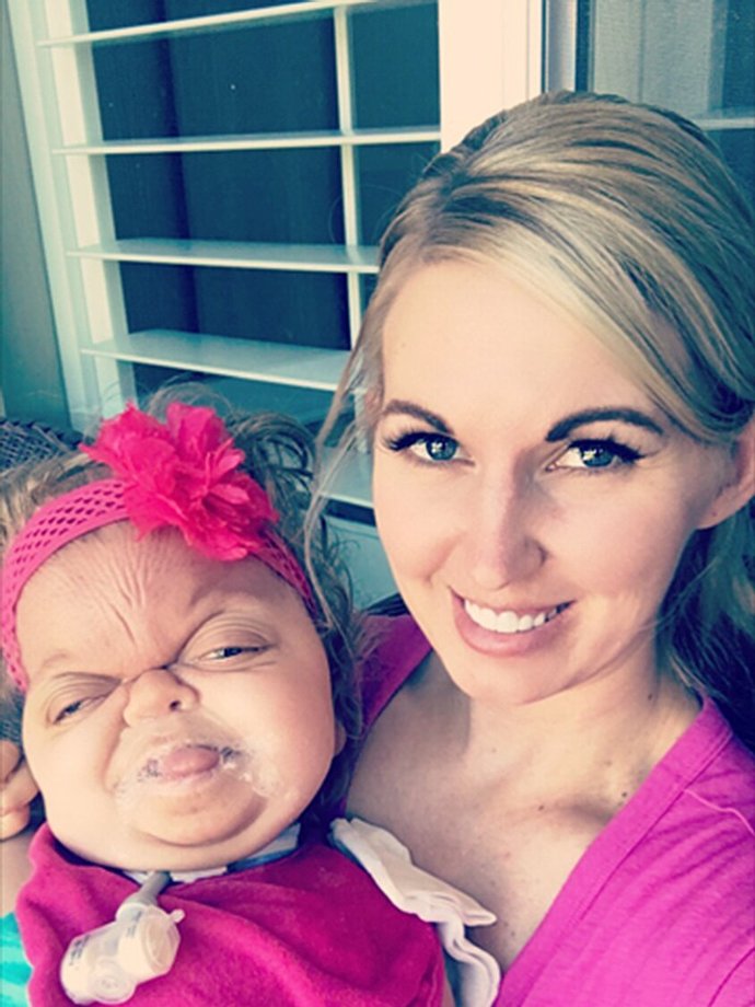 If your child came out like looking like this along with many other medical problems would you keep it?