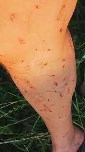 Did you know West Nile virus kills 4% of those who get it, what should we do?