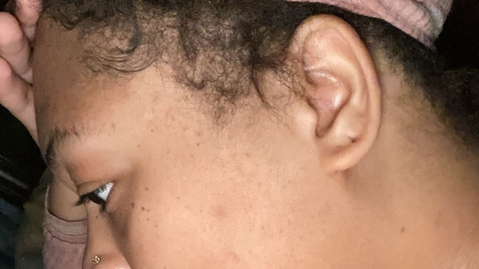 Skin care routine? by the way does this look like freckles on my forehead?