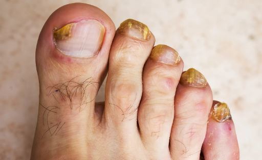 Today is national Love My Feet Day...it is celebrated in observance of healthy, happy feet...any plans to show your feet some love?