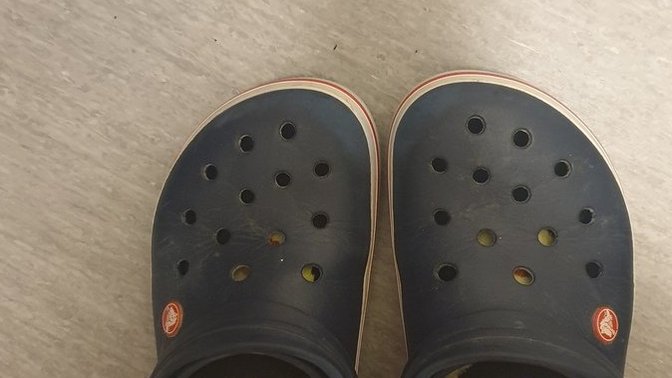 Is it embarrassing to wear Crocs in the shared kitchen?