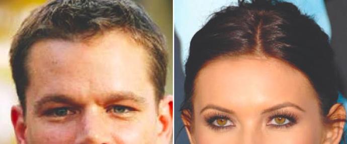 Girls, Female hairline or male hairline?