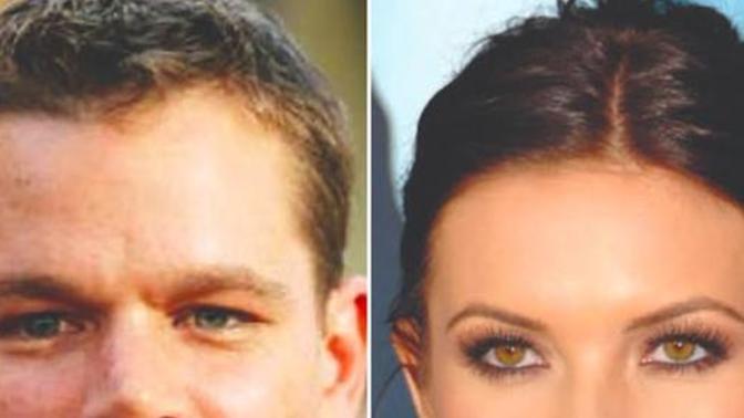 Girls, Female hairline or male hairline?