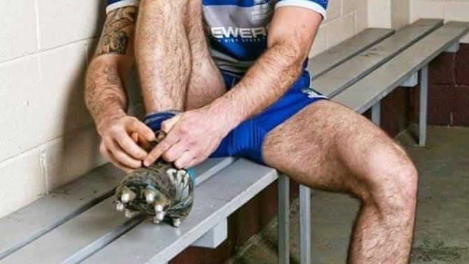 Are my legs considered hairier than normal for a 25 year old guy?