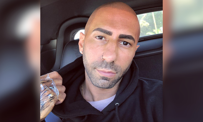 Which race suites bald guys the best?
