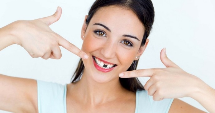 Would you date someone whos missing some teeth?