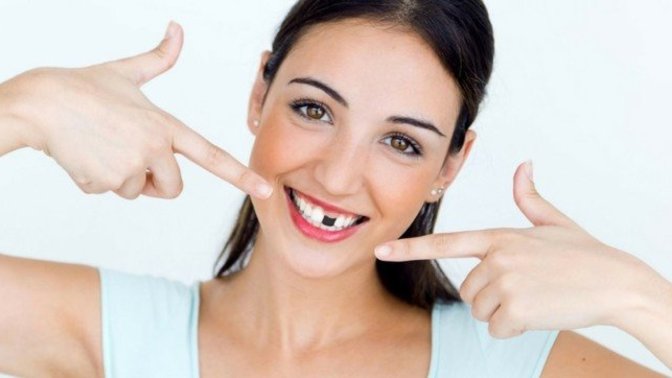 Would you date someone who's missing some teeth?