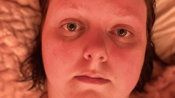 I’m ugly and hate myself. What can I do?