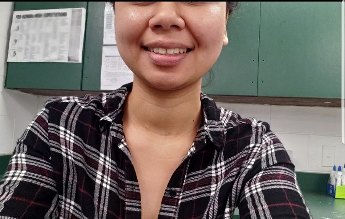 Is it a turn off when a girl has a gap between her teeth?