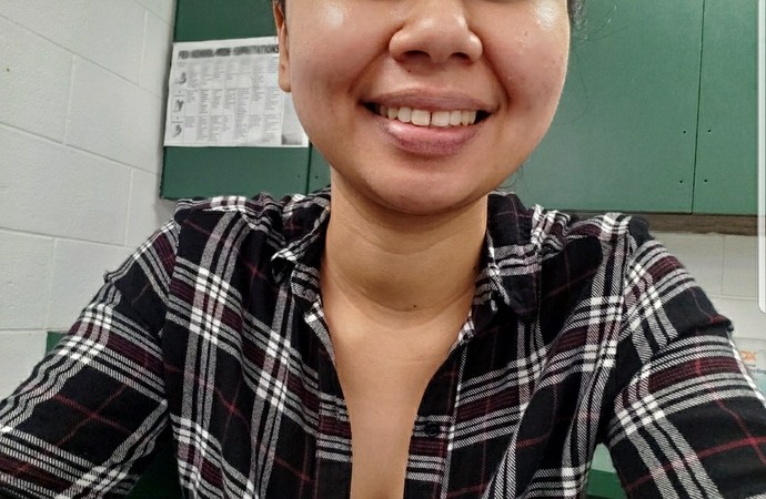 Is it a turn off when a girl has a gap between her teeth?