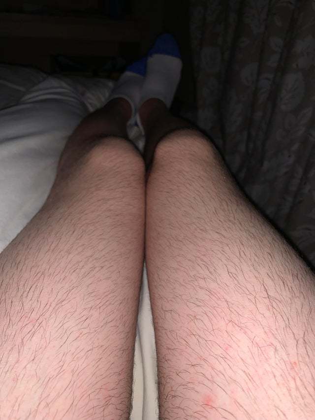 Should I continue to grow it out more or shave/close trim it back?